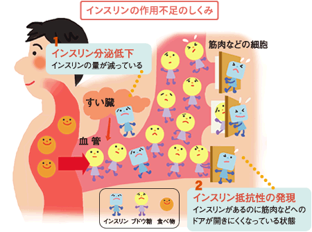 糖尿病の詳細 笠井クリニック 内科 小児科 心療内科などの総合医院 東京都福生